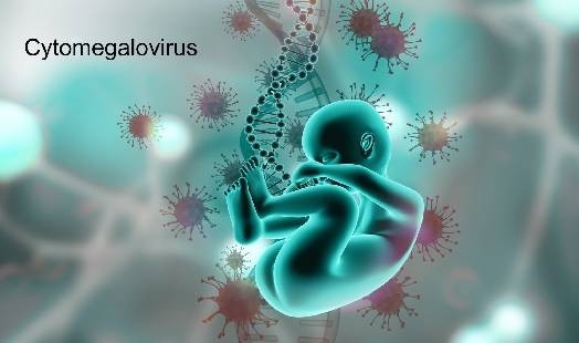 Cytomégalovirus (CMV) : Symptômes et Traitement