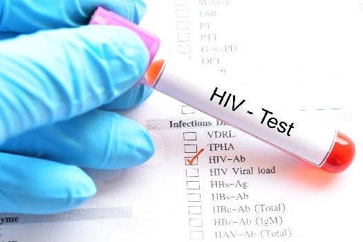 La différence entre Sida et VIH