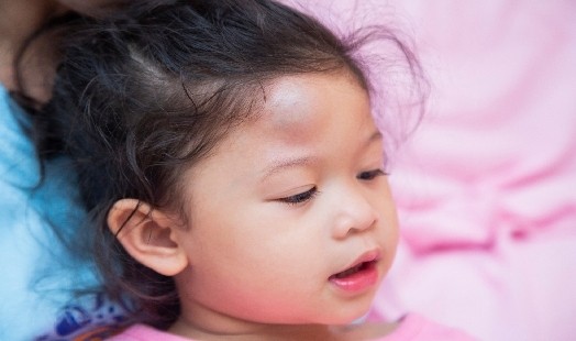 Comment soigner une bosse sur le front ou un œuf de pigeon ?