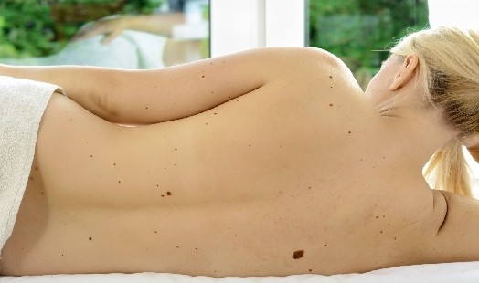 Grains de beauté : comment savoir s’ils sont dangereux ?