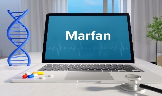 Syndrome de Marfan : symptômes et conséquences