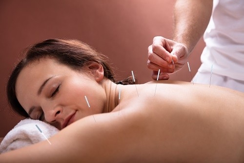 Acupuncture : principe et bienfaits pour la santé