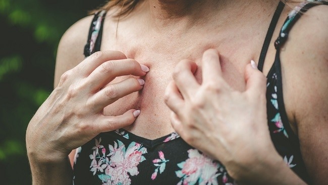 Allergie au soleil : causes, prévention et traitement