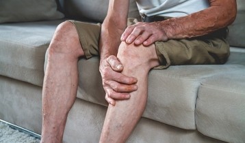 L’artérite : symptômes, conséquences et traitements