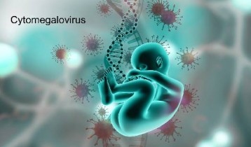 Cytomégalovirus (CMV) : Symptômes et Traitement