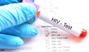 La différence entre Sida et VIH