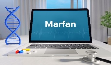 Syndrome de Marfan : symptômes et conséquences