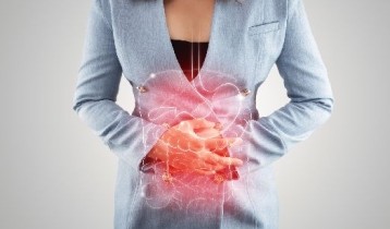 Le Syndrome du colon irritable qu'est-ce que c'est ?