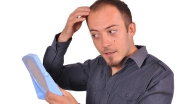 Origines et traitements de l'alopécie androgénique