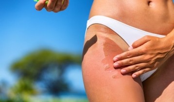 Après soleil : quel soin réparateur choisir ?