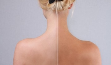 Comment choisir son autobronzant ?