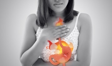 Brûlures d'estomac et reflux gastro-œsophagien : causes et traitements