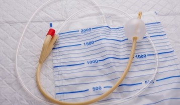 Sondage urinaire et stomie en cas de rétention d'urine