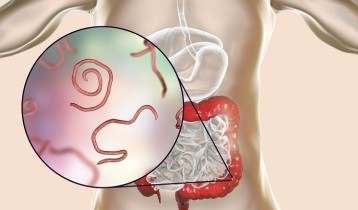 Vers intestinaux : quels sont les traitements ?