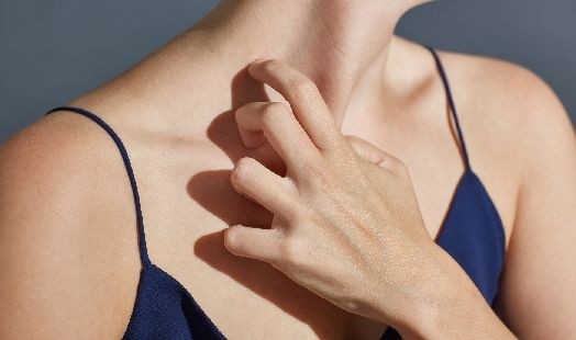 Boutons d’allergie au soleil : quels sont les traitements pour les faire disparaitre ?
