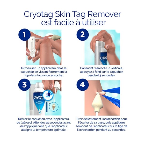Cryotag Skin Tag Remover Traitement des acrochordons