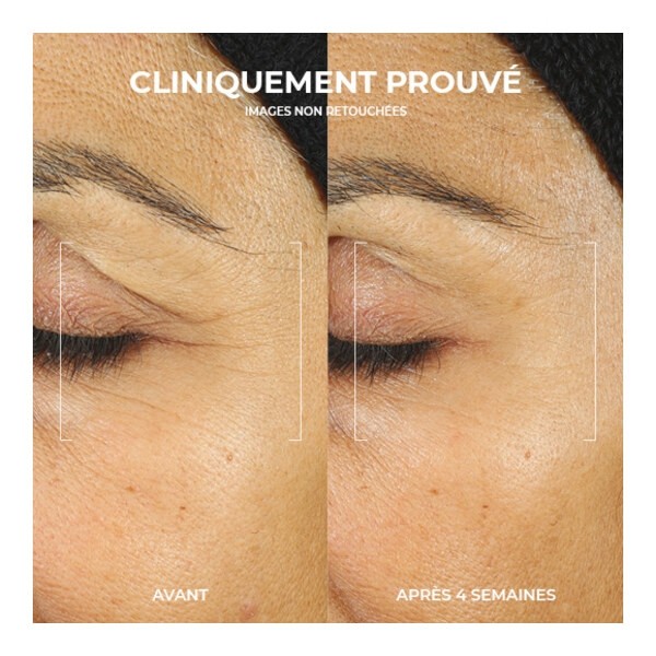 Roc Retinol Correxion Crème contour des yeux