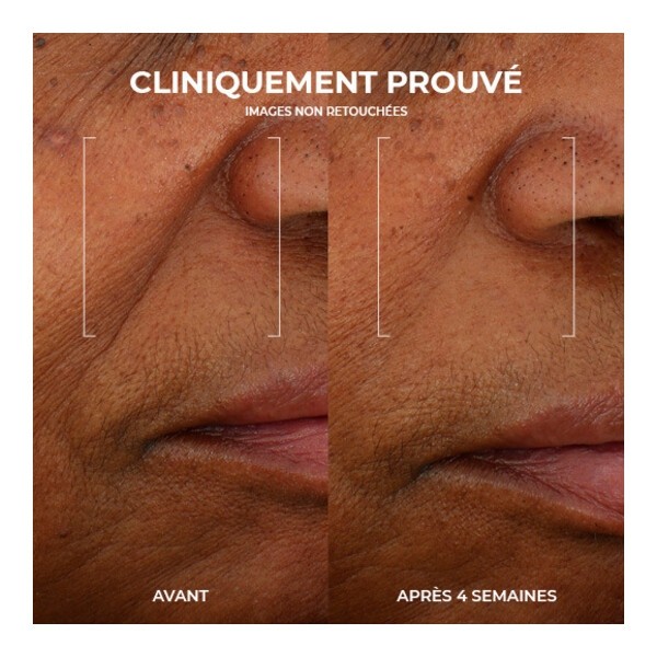 Roc Multi Correxion Crème gel Renouveau Eclat