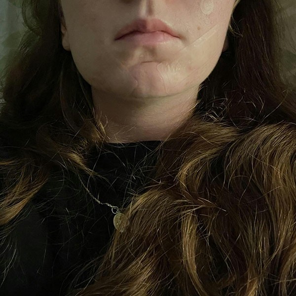 Dr Herma Patch anti boutons​ format Large