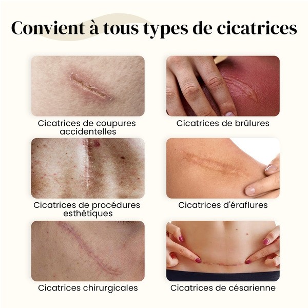 Dermatix gel silicone cicatrice