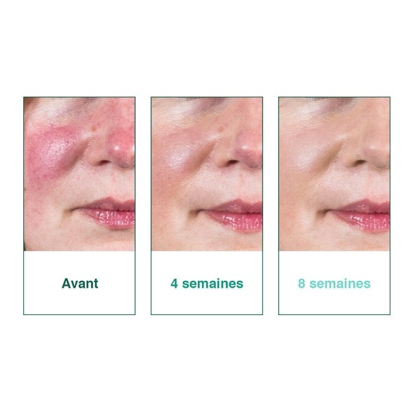 Deruba crème anti-rougeurs SPF 50+