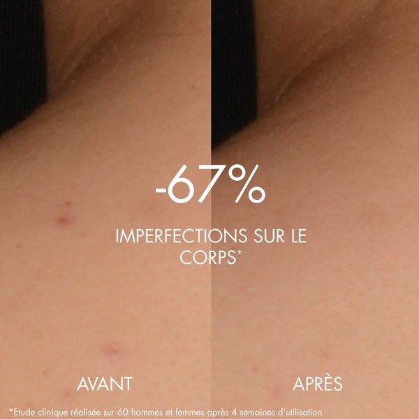 Biotherm biocorps sérum corps peeling peau neuve