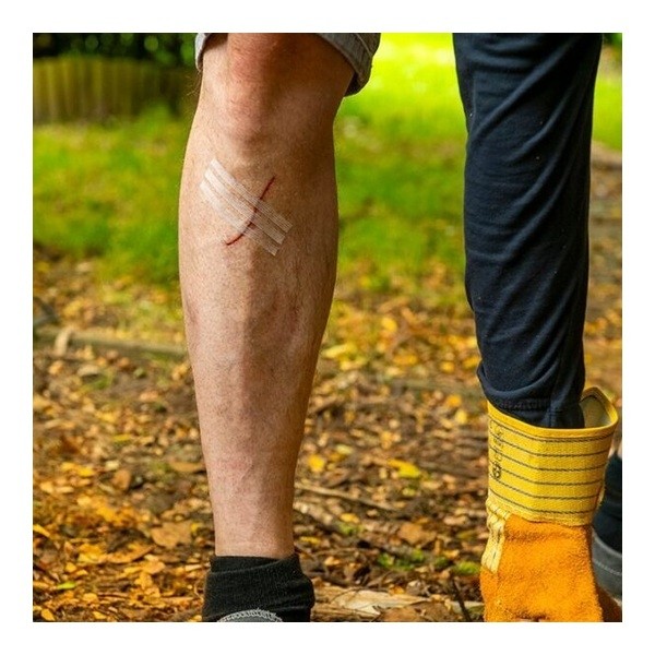 Velpeau Strips Suture adhésive stérile