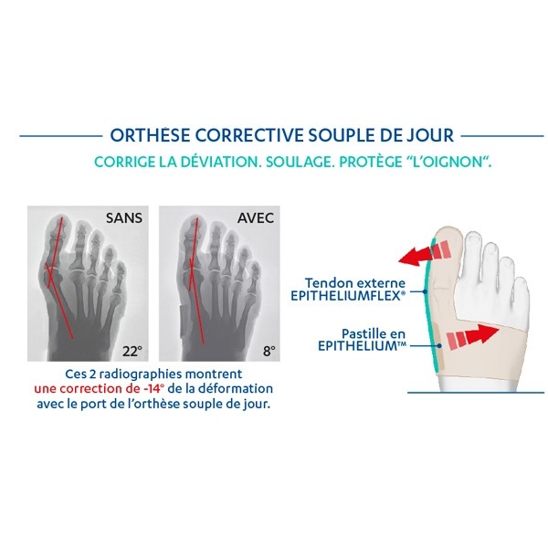Epitact Epithelium Flex orthèse hallux valgus oignon