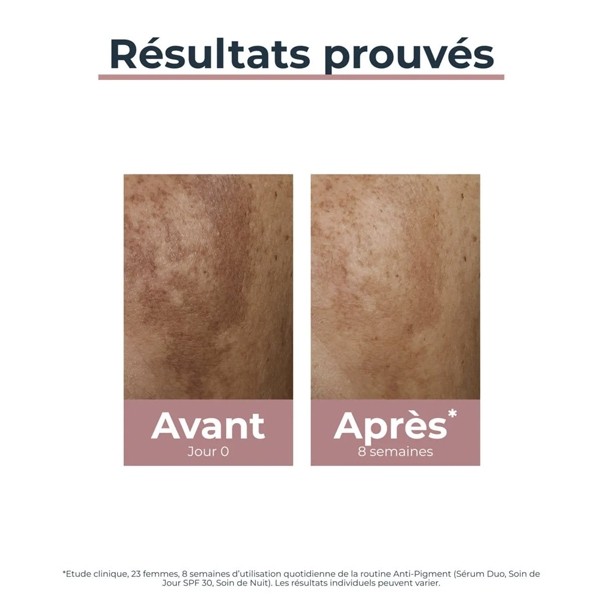 Eucerin Anti Pigment Serum Duo