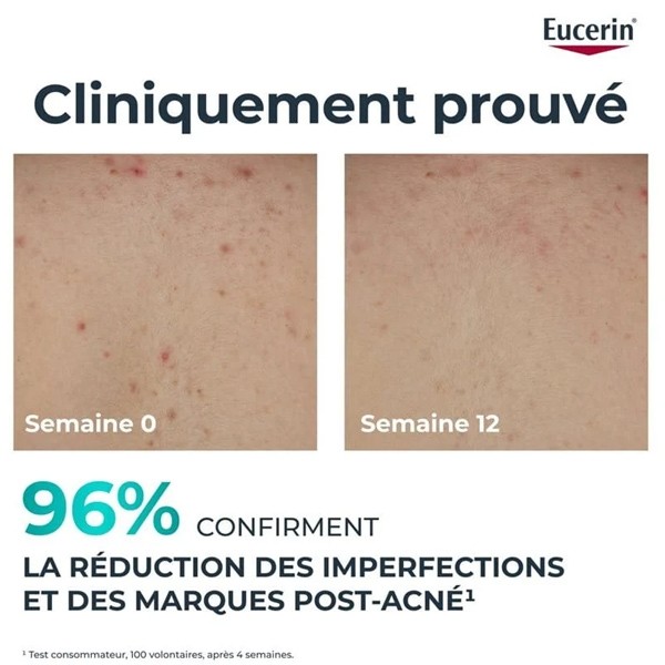 Eucerin DermoPure Crème Corps Correctrice