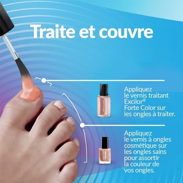 Excilor Forte Color vernis mycose ongle