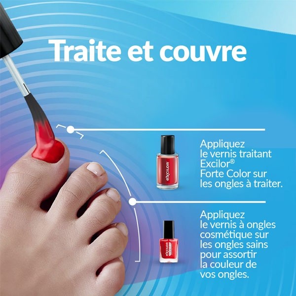 Excilor Forte Color vernis mycose ongle