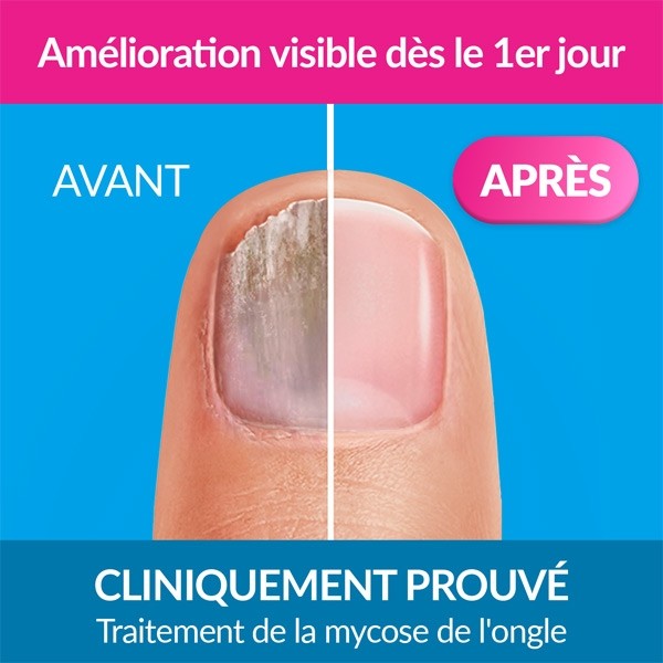 Excilor Forte solution filmogène