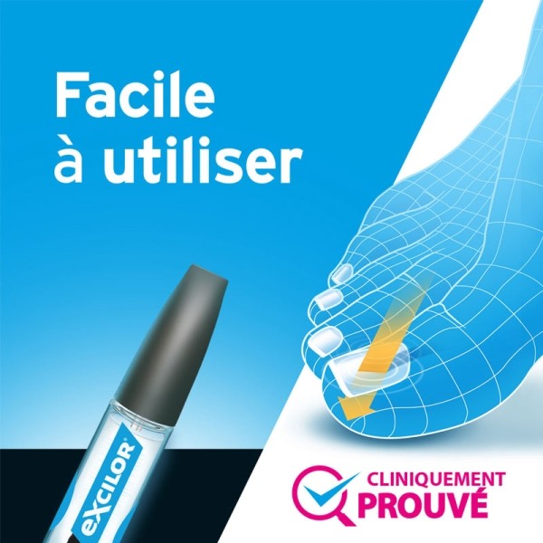 Excilor Traitement contre la mycose de l'ongle