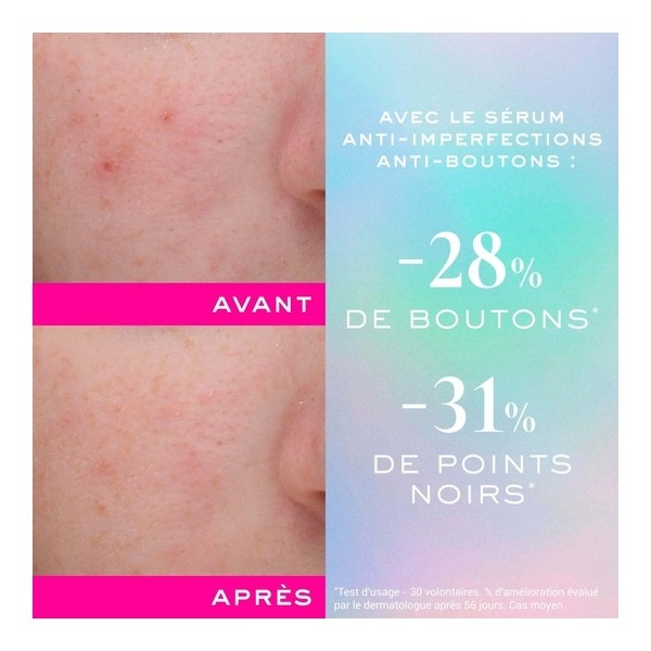 Nuxe Zinc Power Sérum Anti imperfections Anti boutons