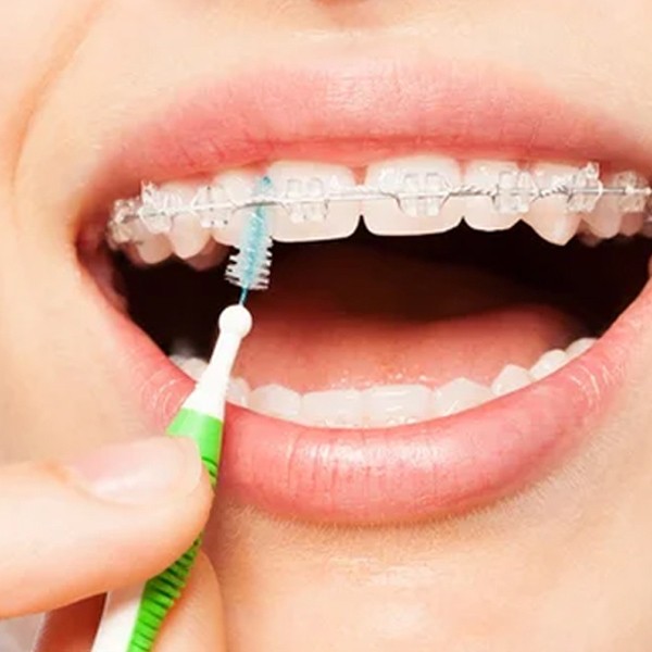 Gum Trav-Ler brossette interdentaire conique