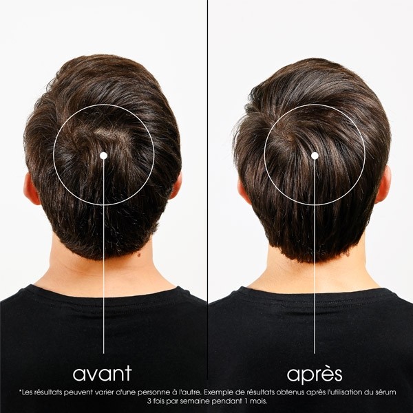 Klorane Anti chute de cheveux Traitement fortifiant intense