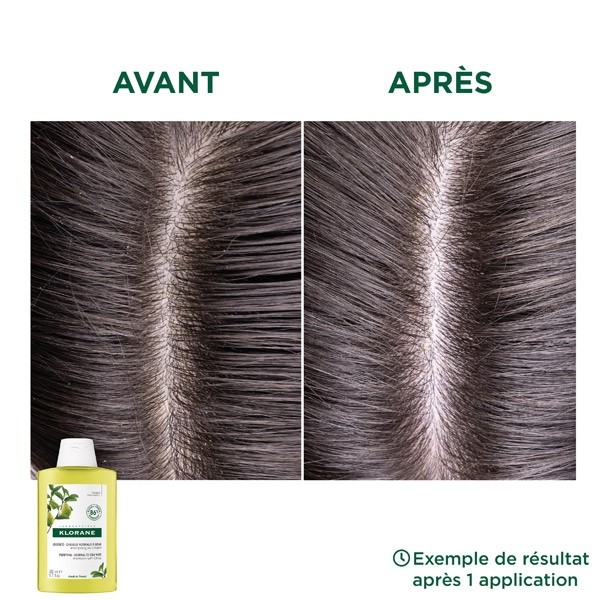 Klorane shampoing Vitalité au Cédrat