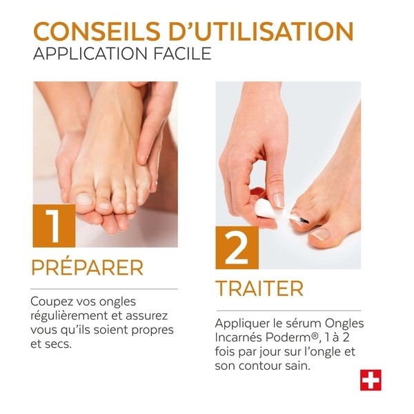 Poderm Ongles incarnés Sérum