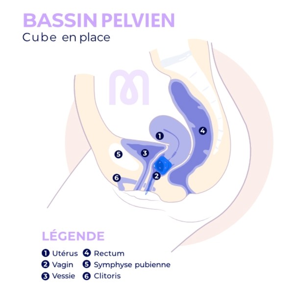 Pessaire Cube perforé Dr Arabin