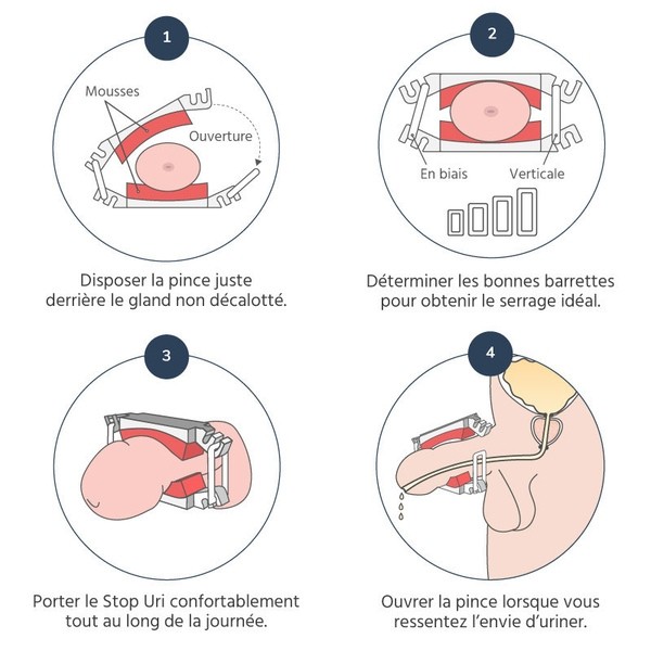 Stop Uri pince pénienne pour incontinence masculine