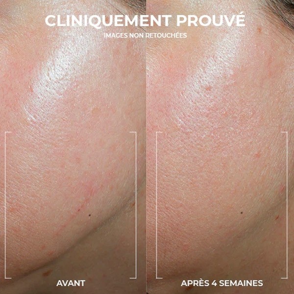 Roc Derm Correxion Crème contour Rétinol Avancé