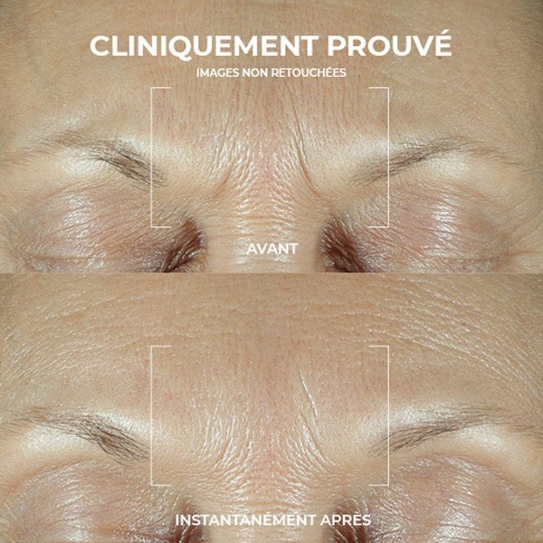 Roc Derm Correxion Sérum combleur rides