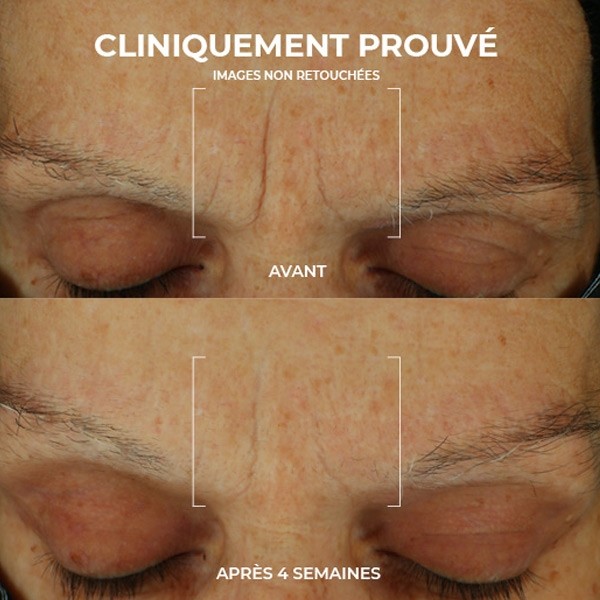 Roc Retinol Correxion soin lissant crème hydratation maximale