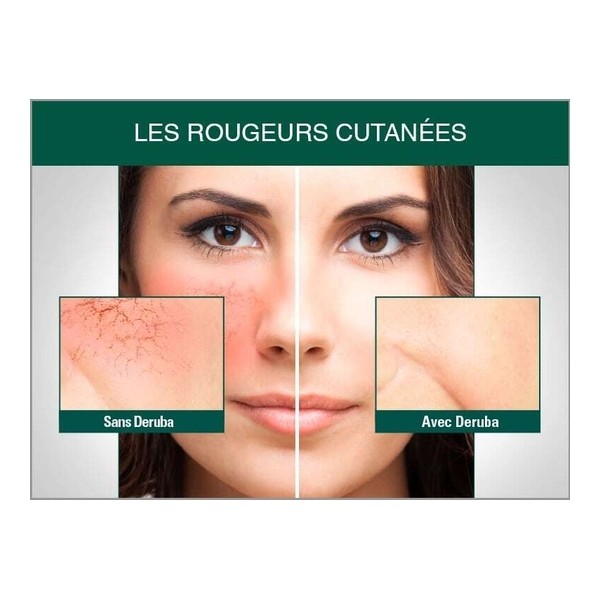 Deruba crème anti-rougeurs SPF 50+