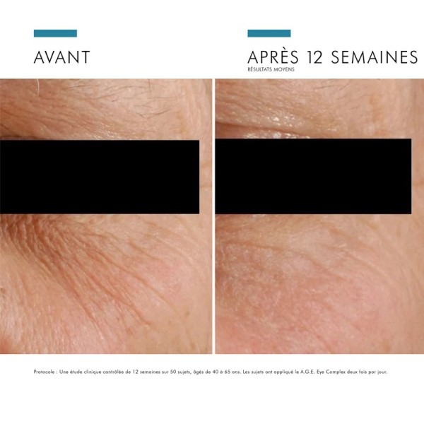 SkinCeuticals A.G.E. Advanced Eye