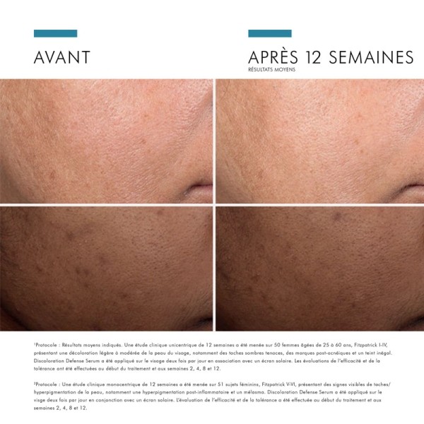 SkinCeuticals Discoloration Defense Serum