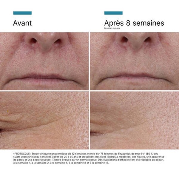 SkinCeuticals P-Tiox Sérum