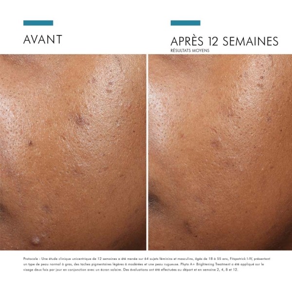 Skinceuticals Phyto A+ Brightening Treatment