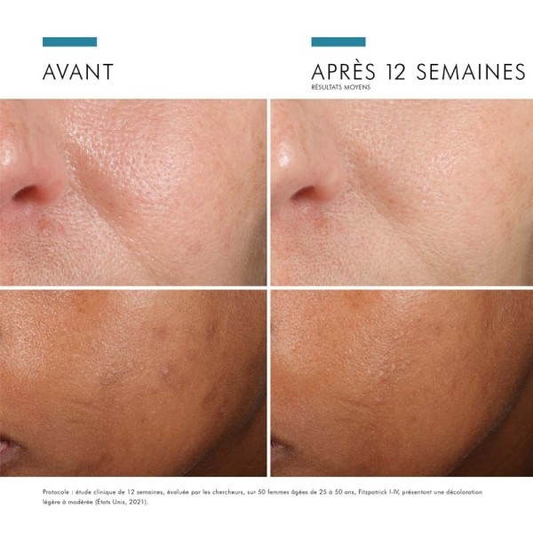 SkinCeuticals Prevent Phloretin CF sérum antioxydant